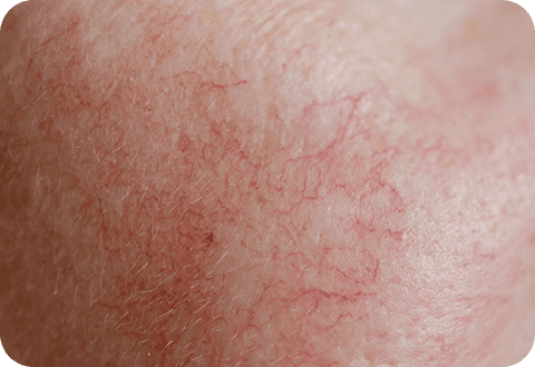 dermav 03