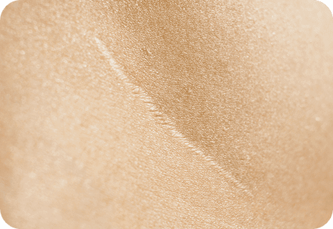 c02 laser 02